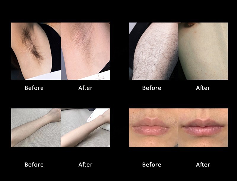Effect comparisons